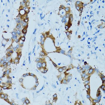 Immunohistochemistry - CTSE antibody (144-02678)