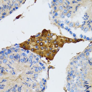 Immunohistochemistry - PGRMC1 antibody (144-05619)