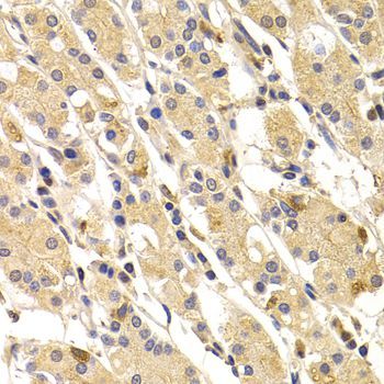Immunohistochemistry - TNNI3 antibody (144-06995)