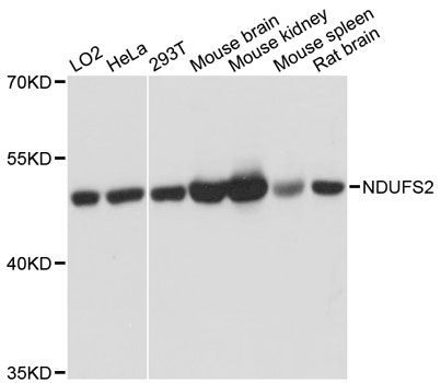 Western blot - [KO Validated] NDUFS2 Polyclonal Antibody (144-601078)