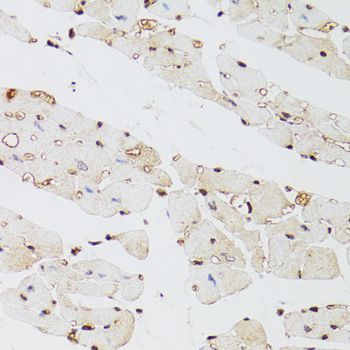 Immunohistochemistry - KDM4A Polyclonal Antibody (144-07953)