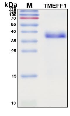 SDS-PAGE Image