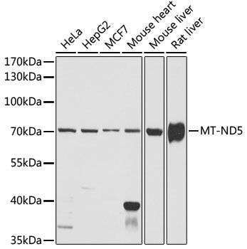 Western blot
