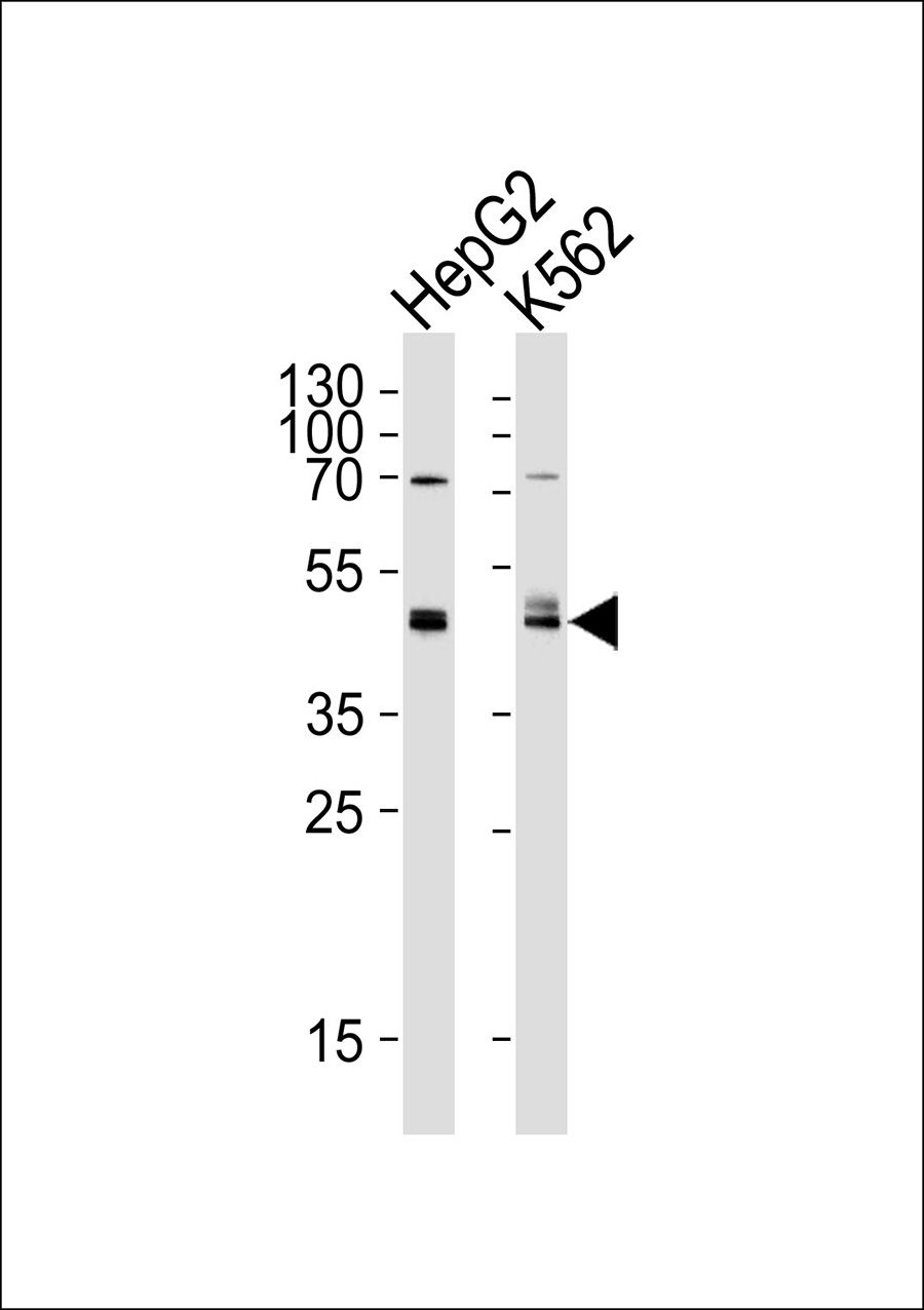 WB