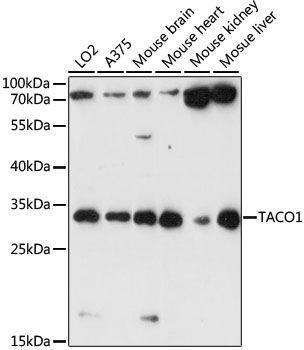 Western blot - TACO1 antibody (144-61060)