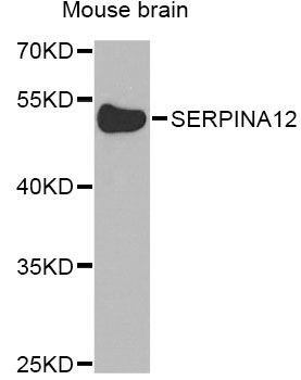 Western blot - SERPINA12 Antibody (144-08074)