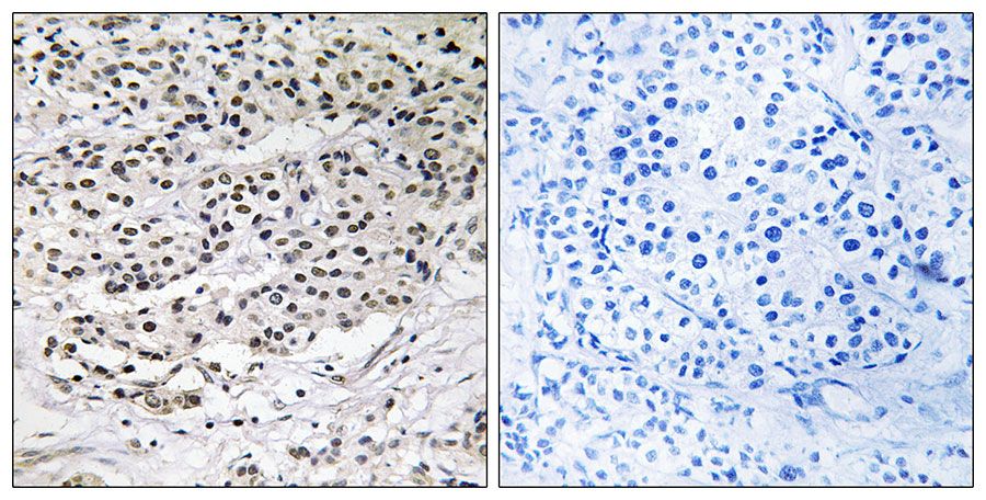 IHC