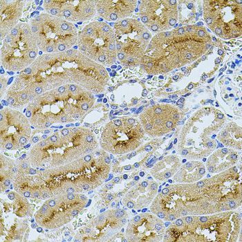 Immunohistochemistry - TEFM Polyclonal Antibody (144-08511)