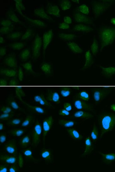 Immunofluorescence - EPPIN antibody (144-02149)