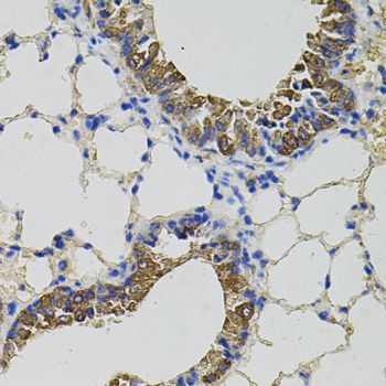 Immunohistochemistry - CKAP4 Polyclonal Antibody (144-07777)