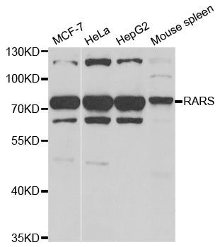 Western blot - RARS antibody (144-06307)