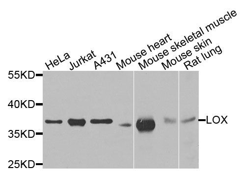 Western blot - LOX antibody (144-07698)