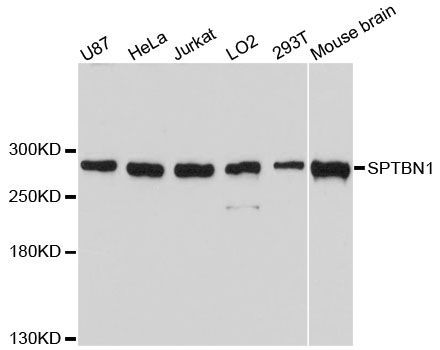 Western blot - SPTBN1 antibody (144-05253)