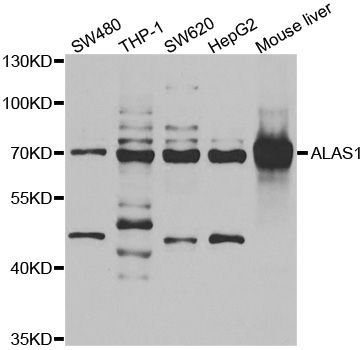 Western blot - ALAS1 antibody (144-06521)