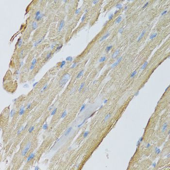 Immunohistochemistry - CKMT2 antibody (144-08088)