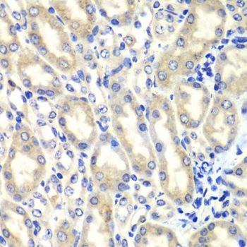 Immunohistochemistry - PTGES2 Polyclonal Antibody (144-07137)