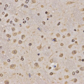 Immunohistochemistry - MonoMethyl-Histone H3-K36 pAb (144-02364)