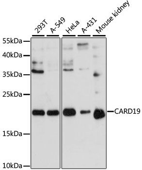 Western blot - CARD19 Polyclonal Antibody (144-60232)