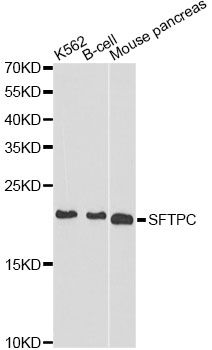 Western blot - SFTPC antibody (144-01835)