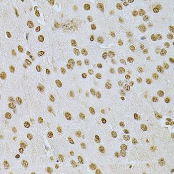 Immunohistochemistry - ILK Polyclonal Antibody (144-00901)