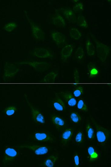 Immunofluorescence - UGT1A9 antibody (144-01661)