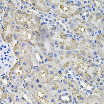 Immunohistochemistry - ACO1 antibody (144-07867)
