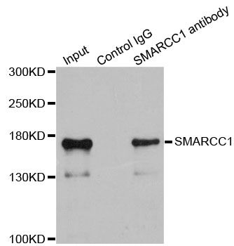 Immunohistochemistry - [KO Validated] SMARCC1 Polyclonal Antibody (144-06128)