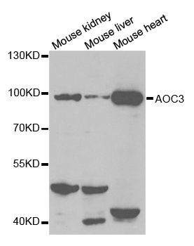 Western blot - AOC3 Polyclonal Antibody (144-02001)