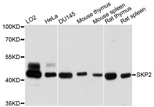 Western blot - SKP2 antibody (144-61452)