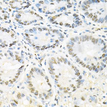 Immunohistochemistry - SNRPE Antibody (144-05488)