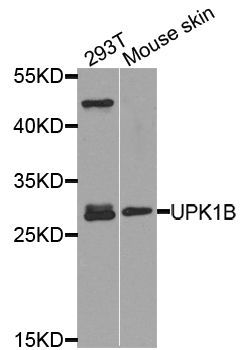 Western blot - UPK1B antibody (144-08157)