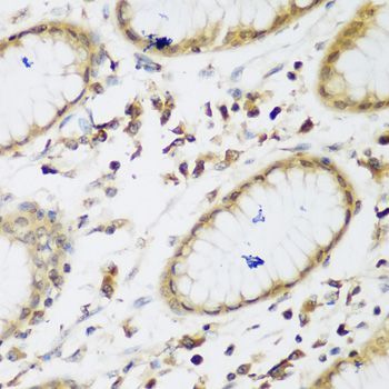 Immunohistochemistry - UBE3A antibody (144-01757)