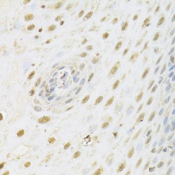Immunohistochemistry - HDAC3 Polyclonal Antibody (144-02139)