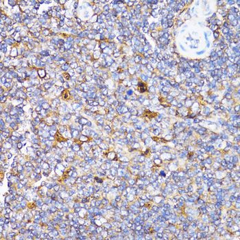 Immunohistochemistry - TOLLIP antibody (144-02202)