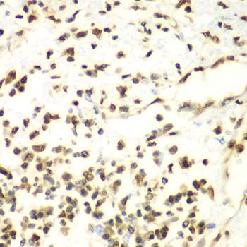 Immunohistochemistry - HDAC2 Polyclonal Antibody (144-02084)