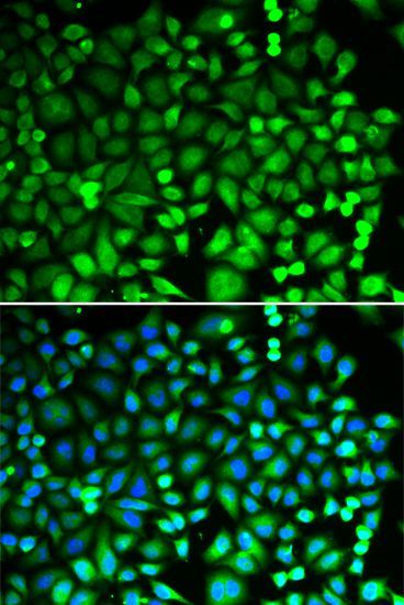 Immunofluorescence - PSMB2 antibody (144-013630)
