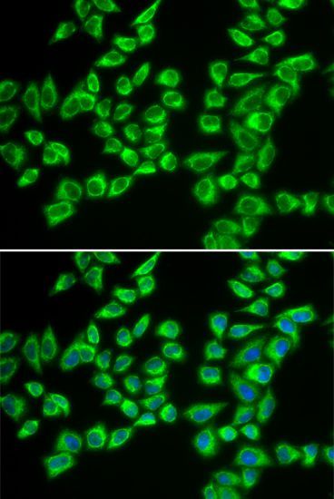 Immunofluorescence - HADHB antibody (144-05716)