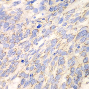 Immunohistochemistry - DLD antibody (144-60270)