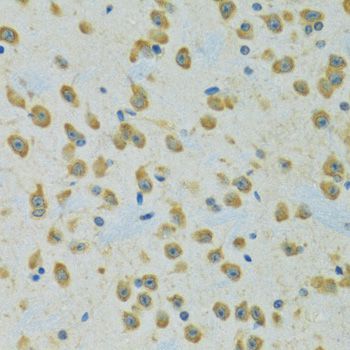 Immunohistochemistry - RPS7 Polyclonal Antibody (144-06731)