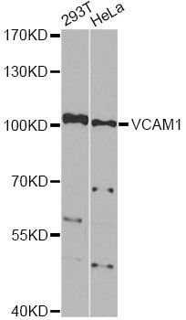 Western blot - VCAM1 Polyclonal Antibody (144-00279)