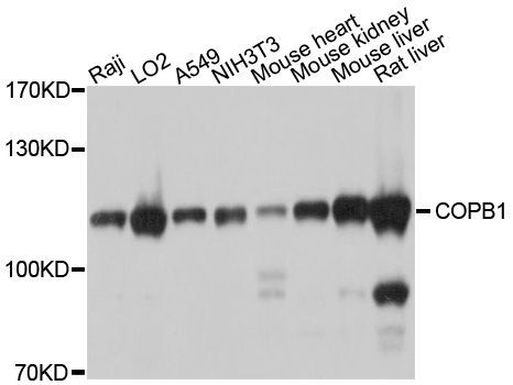 Western blot - COPB1 Polyclonal Antibody (144-600555)