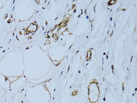 Immunohistochemistry - MCAM antibody (144-60521)