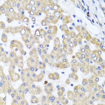 Immunohistochemistry - RAB24 Polyclonal Antibody (144-08394)