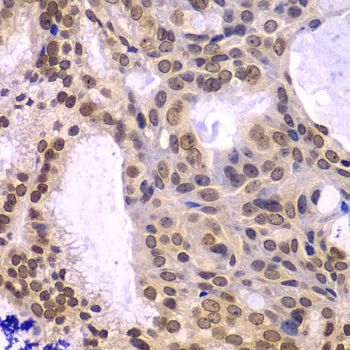 Immunohistochemistry - POLD3 Polyclonal Antibody (144-07243)