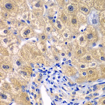Immunohistochemistry - CARD11 antibody (144-07140)