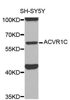 Western blot - ACVR1C Polyclonal Antibody (144-00678)