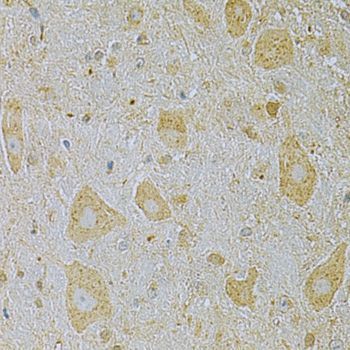 Immunohistochemistry - CAMK1G Antibody (144-07379)