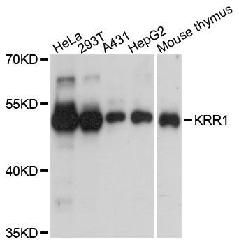 Western blot - KRR1 antibody (144-61388)