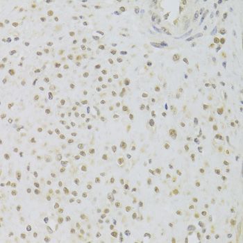 Immunohistochemistry - PRPF3 Polyclonal Antibody (144-05482)