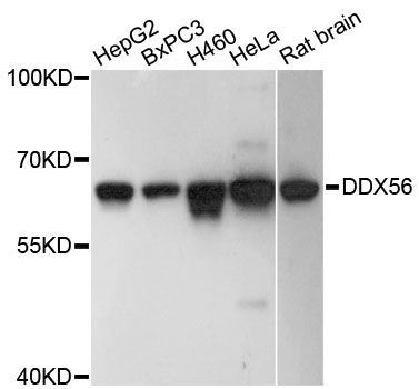 Western blot - DDX56 antibody (144-61478)